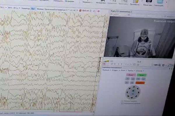 НОЧНОЙ ВИДЕО ЭЭГ-МОНИТОРИНГ позволяет определить есть ли у пациента судорожная активность головного мозга и что провоцирует приступы с потерей сознания, судороги, вздрагивания, замирания, пан