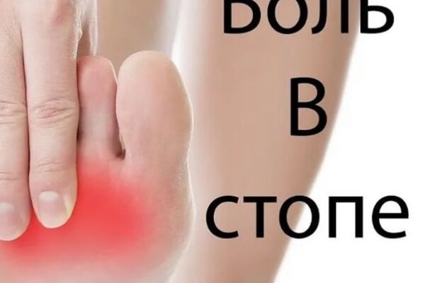 БОЛЬ В СТОПЕ