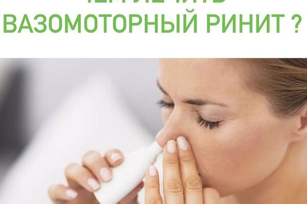 ВАЗОМОТОРНЫЙ РИНИТ.
