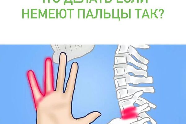 ЧТО ДЕЛАТЬ ЕСЛИ НЕМЕЮТ ПАЛЬЦЫ ТАК?