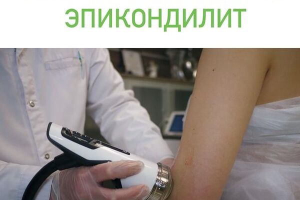 Локоть теннисиста / эпикондилит