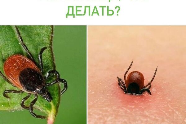 УКУС КЛЕЩА