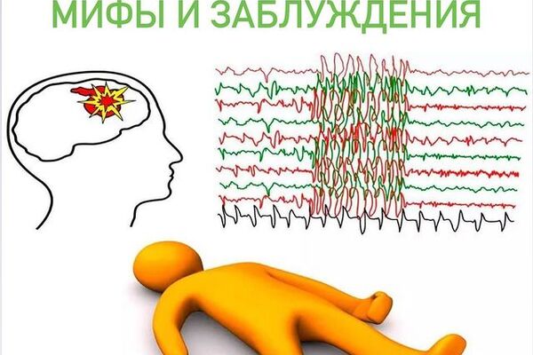 Лечение эпилепсии: мифы и заблуждения.