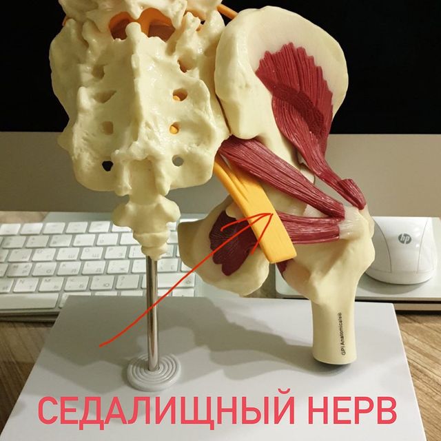 СЕДАЛИЩНЫЙ НЕРВ.