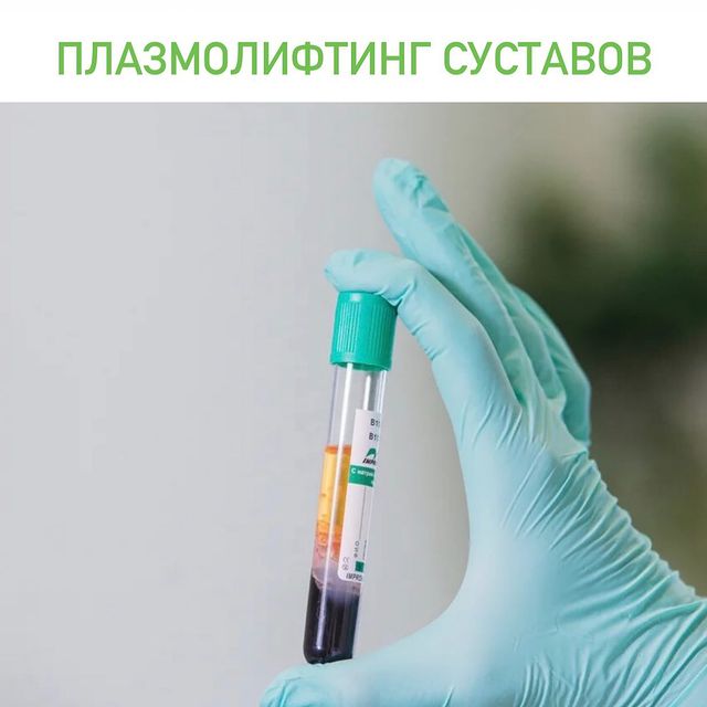 ПЛАЗМОЛИФТИНГ СУСТАВОВ.